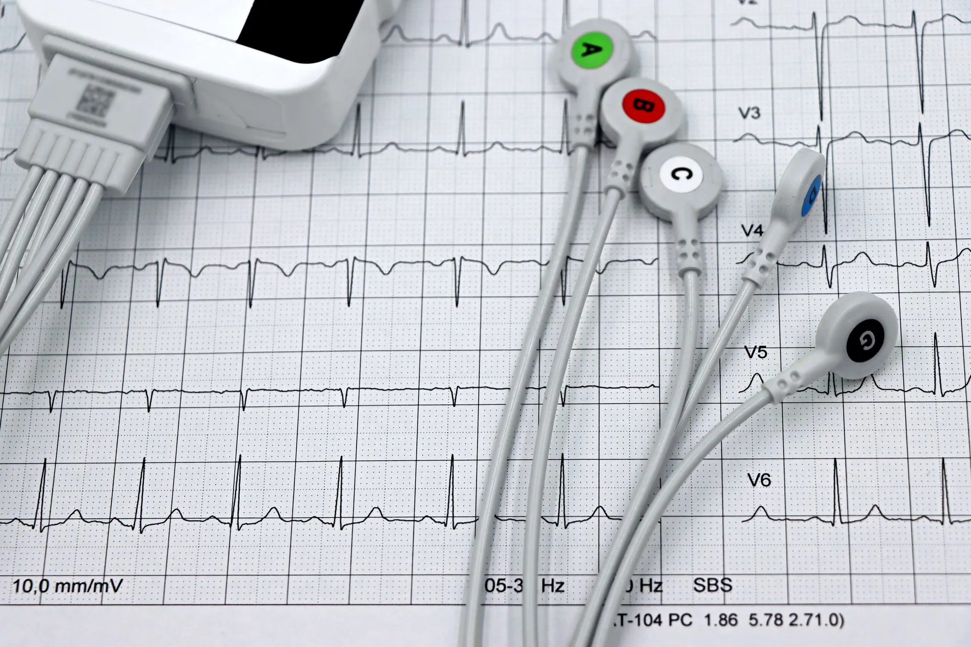 Sahajanand Medical Technologies Secures EU MDR Certification for Supraflex Cruz Product Family, Strengthening Global Compliance and Patient Safety
